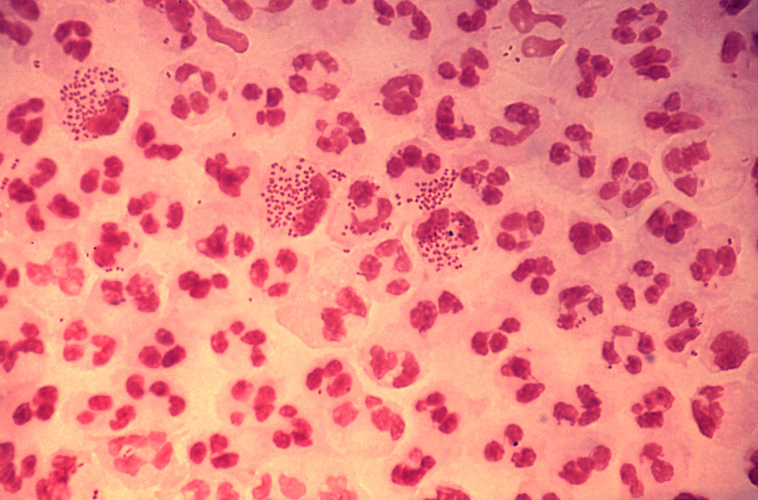 Neisseria gonorrhoeae