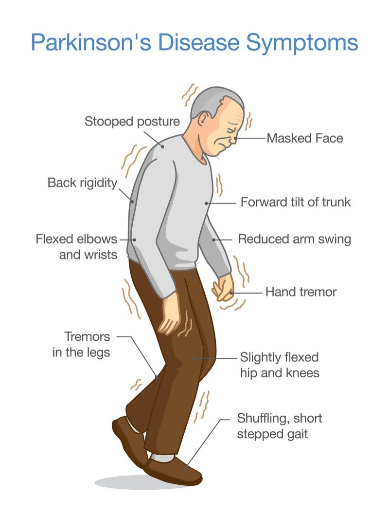 Parkinsons disease