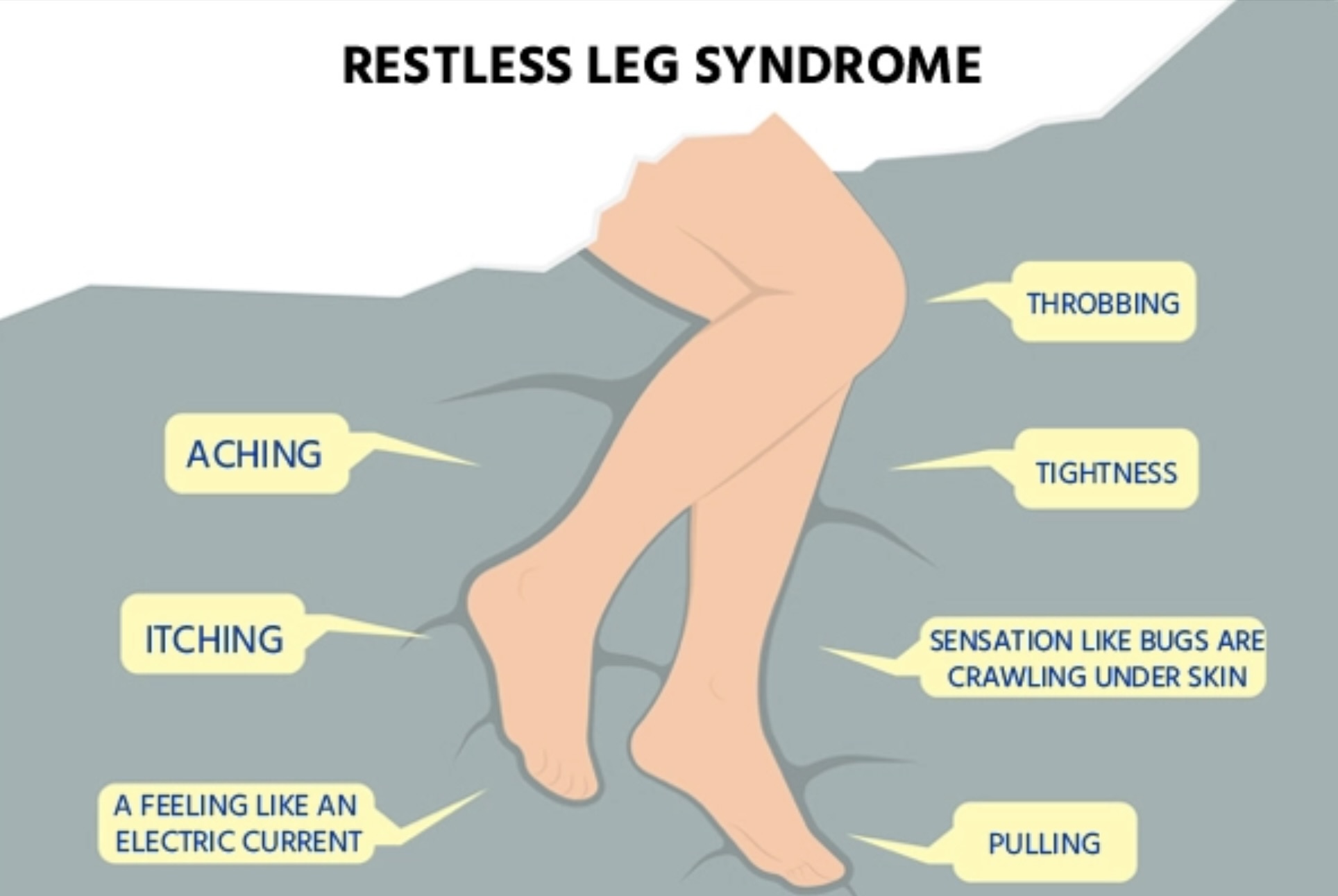 Restless Legs Syndrome