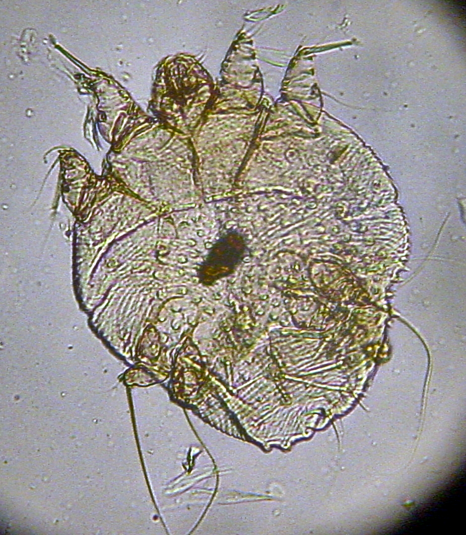 Sarcoptes scabiei mite